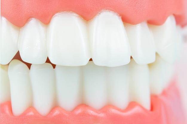 Are false teeth covered on medical card? 