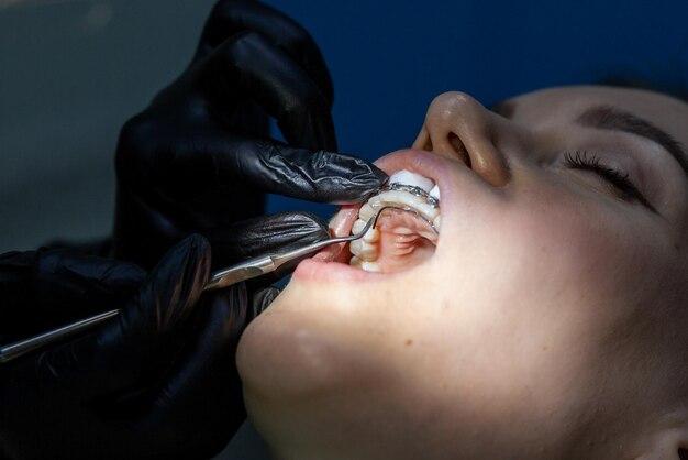 Are piercing retainers allowed in the military? 