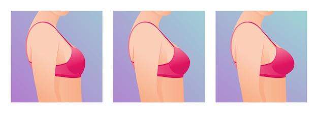 Can collagen make breasts bigger? 