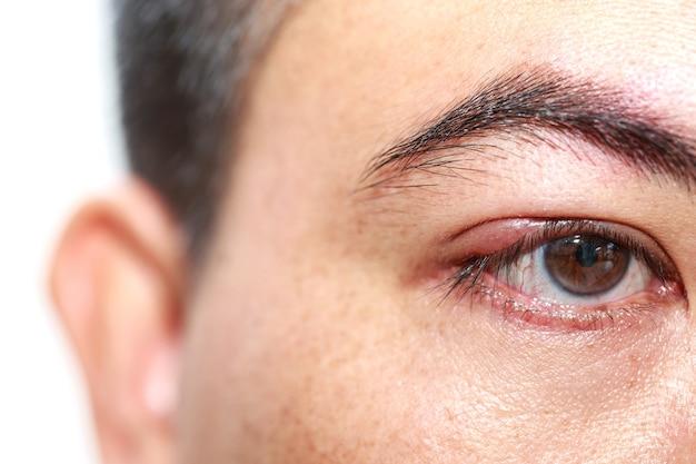 Can damaged eyebrow follicles be repaired? 