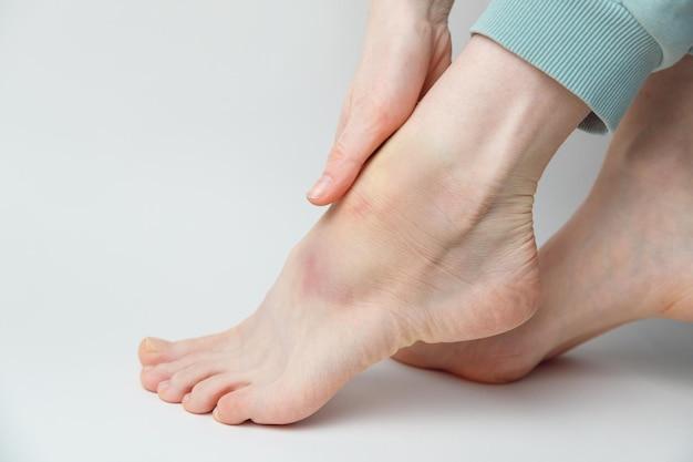 Can I call out of work for a sprained ankle? 