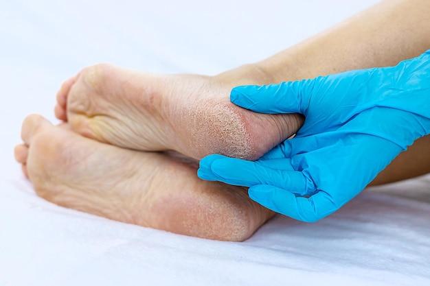 Can nurses cut diabetic toenails? 