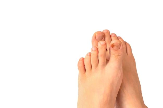 Can toenail fungus enter your bloodstream? 