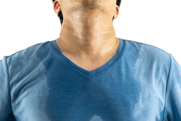 Does metformin cause body odor? 