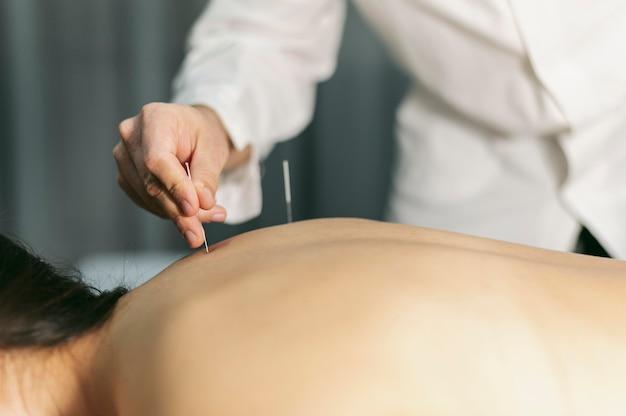 How can acupuncturist tell if you are pregnant? 