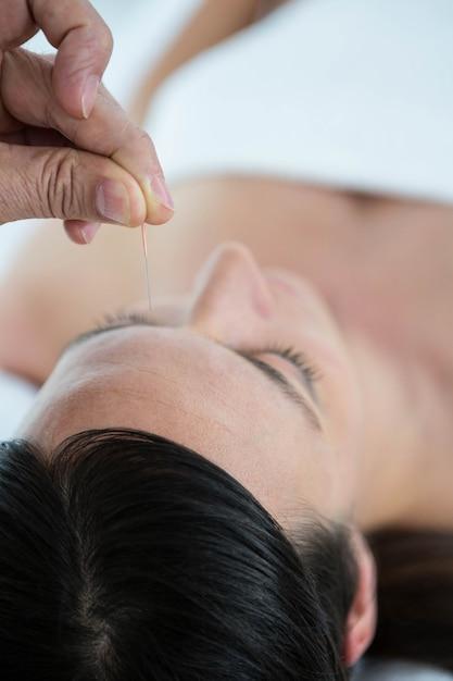 How can acupuncturist tell if you are pregnant? 