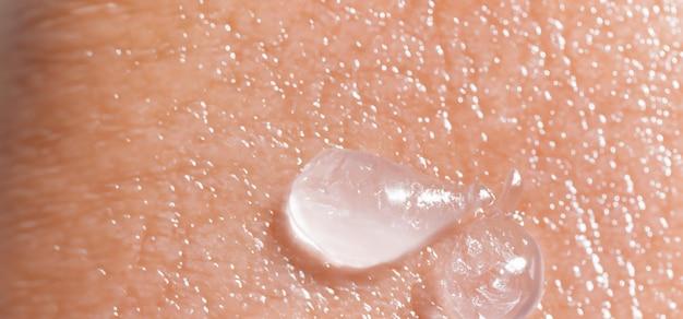 Is Cetaphil good for fungal acne? 