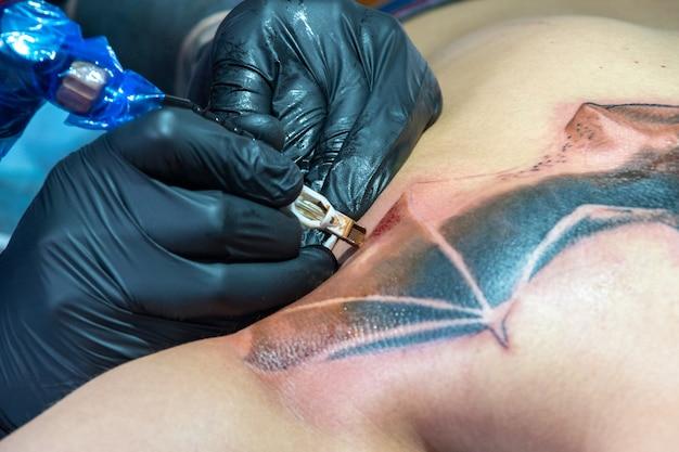 Is red or blue laser better for tattoo removal? 