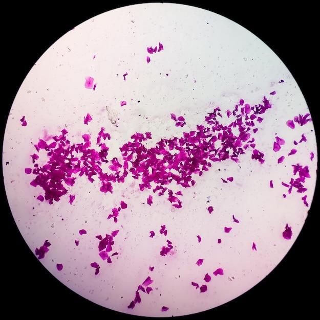 What color does Staphylococcus aureus stain in acid-fast? 