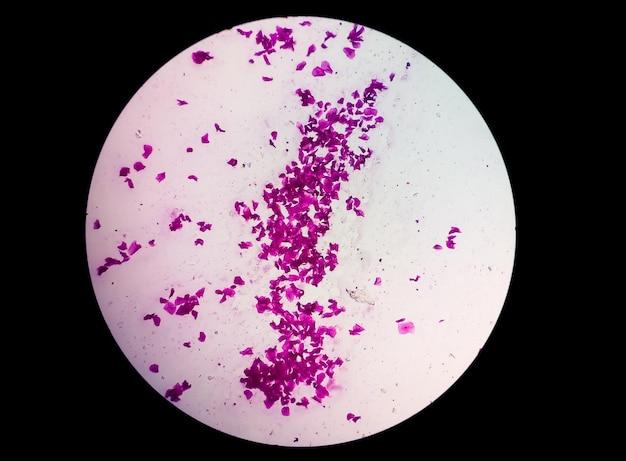 What color does Staphylococcus aureus stain in acid-fast? 