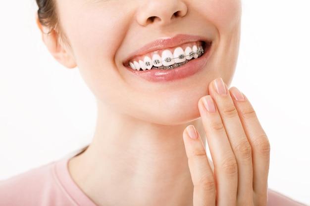 What's the longest time you can wear braces? 