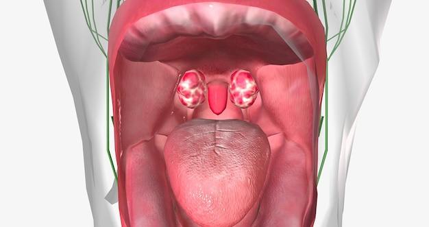 What color should the back of your throat be 