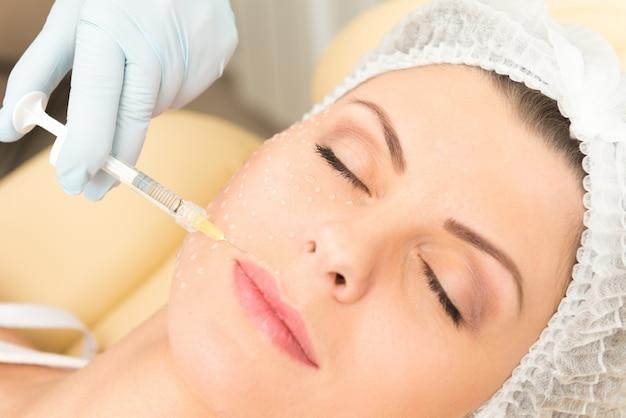 What happens if you dont peel after microneedling? 