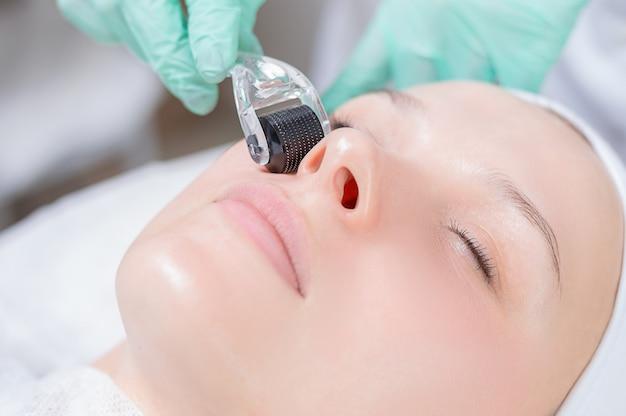 What happens if you dont peel after microneedling? 