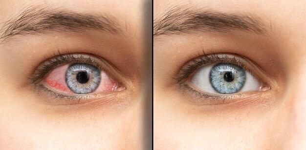 Why do clothes change eye color 