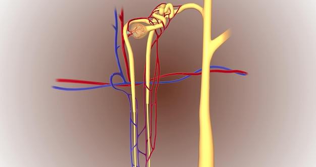 Why do dialysis patients smell like urine 