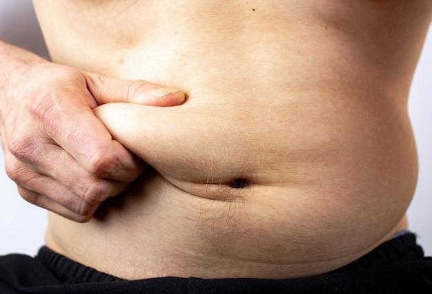Why do my fat folds smell? 