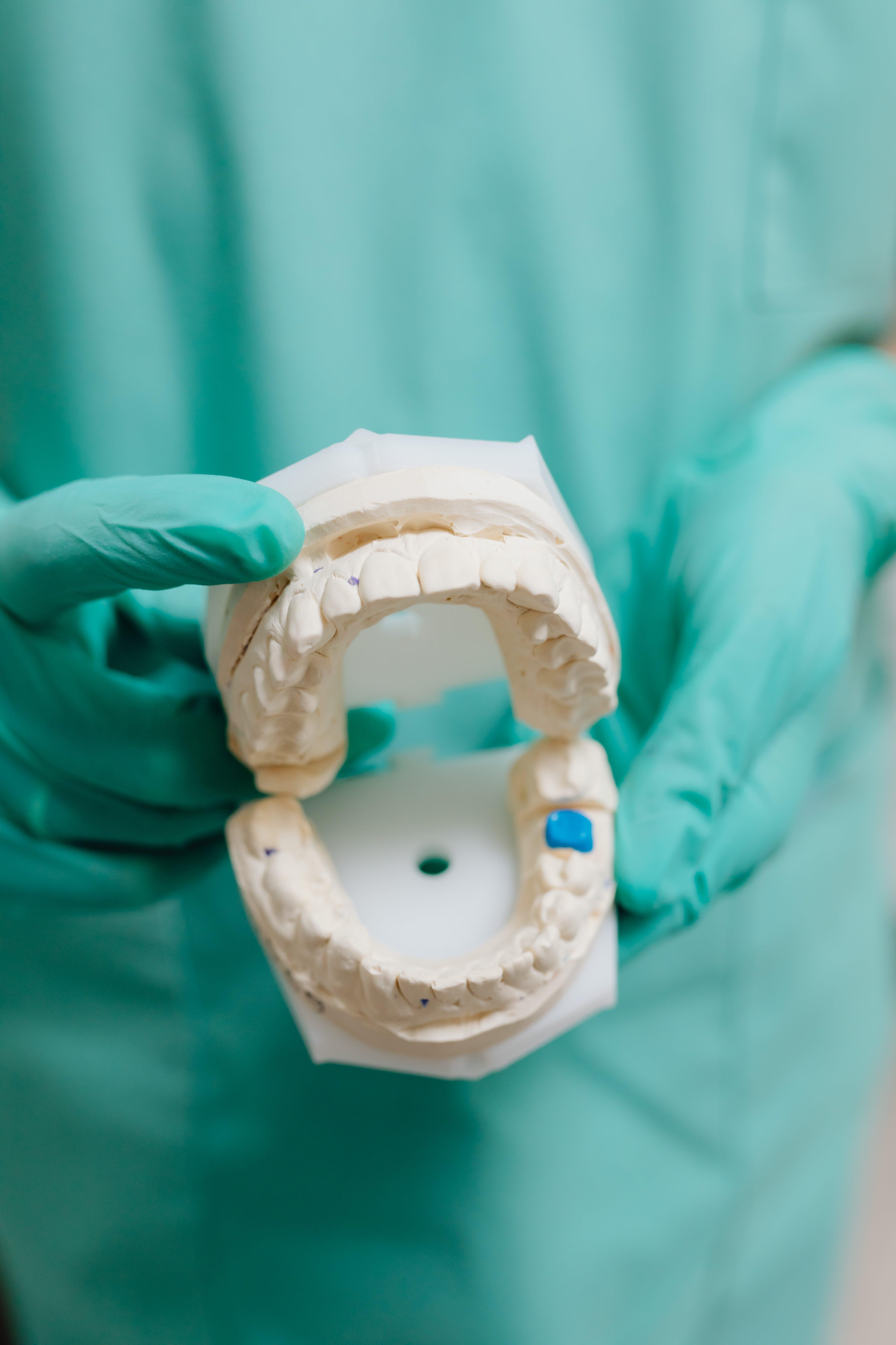 How are alginate impressions removed from the mouth 