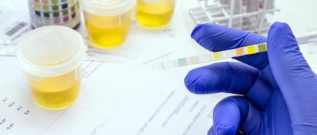 How do I pass an EtG drug test 